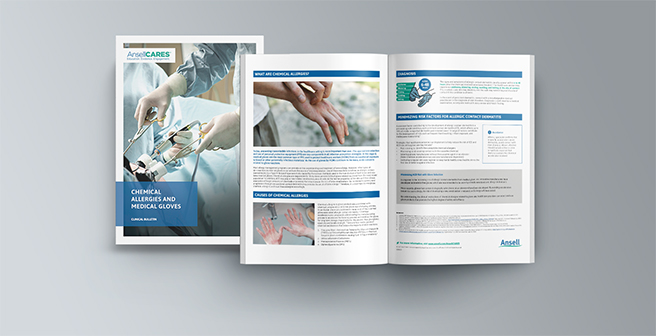 Examining chemical allergies from medical gloves, highlighting skin reactions and safety protocols