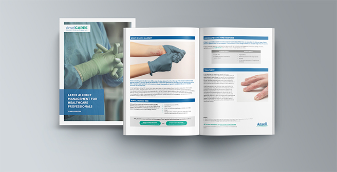 Managing latex allergies in healthcare, including prevention, diagnosis, and treatment