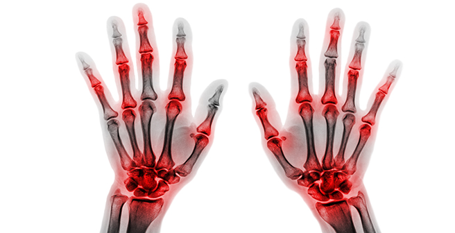 Image of a pair of hands from an X-ray point of view