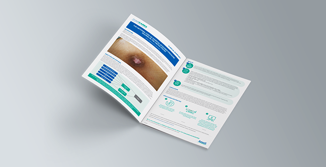 AnsellCARES Clinical Summary Thumbnail - The National Cost of Hospital-Acquired Pressure Injuries in the United States