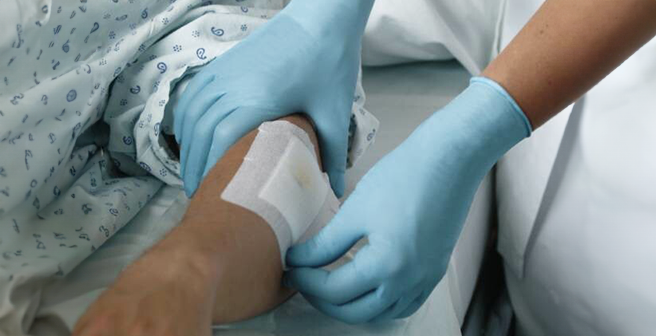 Image of Ansell’s blue nitrile exam gloves being used to treat patient’s wound efficiently thanks to its enhanced protection