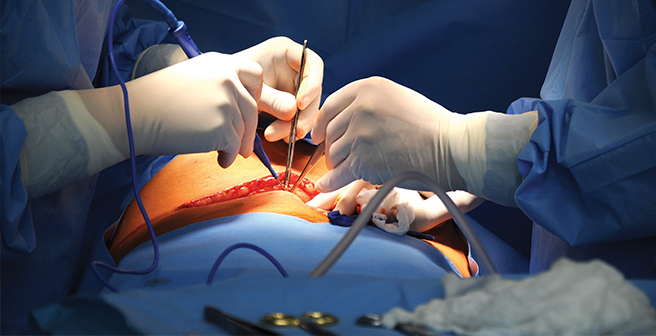 Surgical Application Electrosurgery