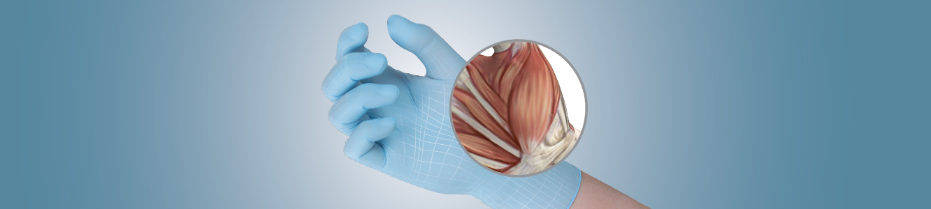 MSD’s or musculoskeletal disorders tend to occur when workers become injured or strained because of repetitive or tedious job functions. 